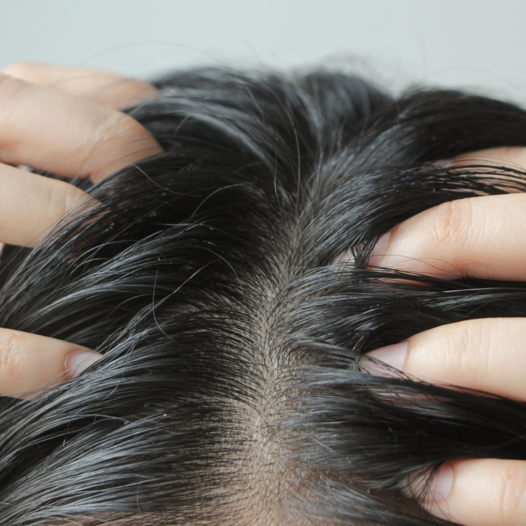 The Unseen Dilemma Addressing Dead Cells on Your Scalp Ardor