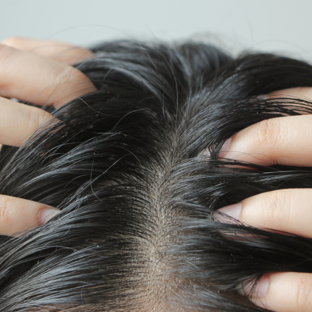 The Unseen Dilemma: Addressing Dead Cells on Your Scalp